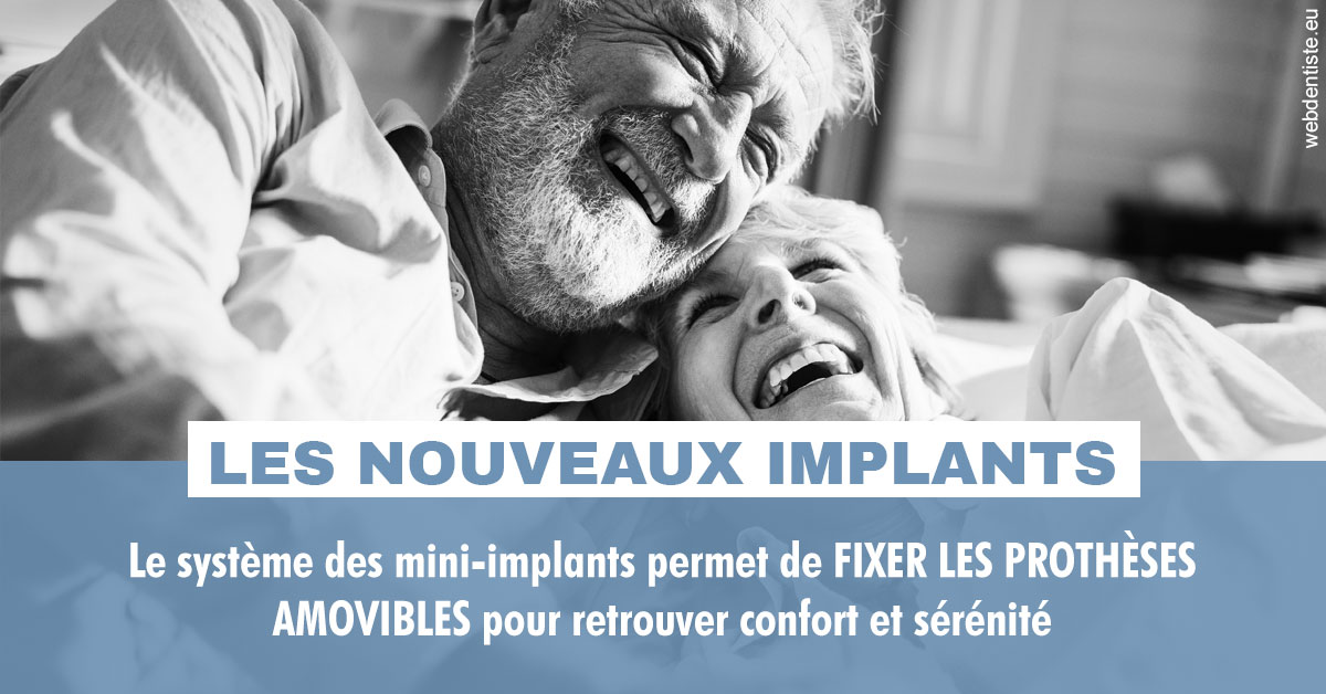 https://dr-laure-roquette.chirurgiens-dentistes.fr/Les nouveaux implants 2
