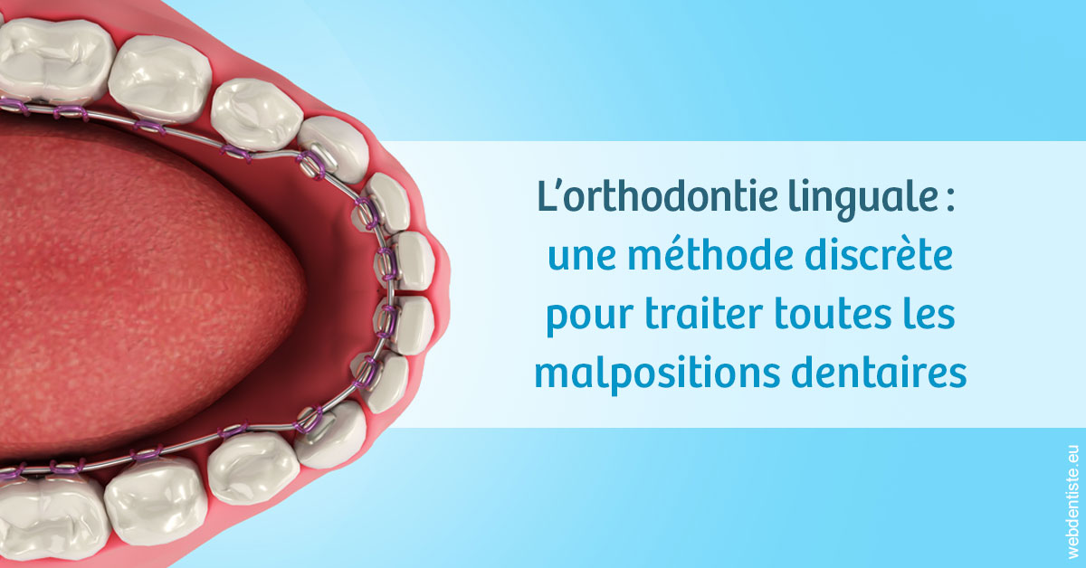 https://dr-laure-roquette.chirurgiens-dentistes.fr/L'orthodontie linguale 1