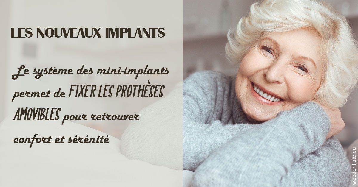 https://dr-laure-roquette.chirurgiens-dentistes.fr/Les nouveaux implants 1