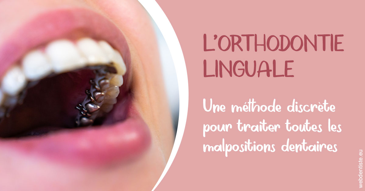 https://dr-laure-roquette.chirurgiens-dentistes.fr/L'orthodontie linguale 2