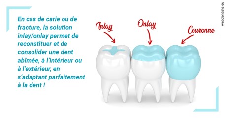 https://dr-laure-roquette.chirurgiens-dentistes.fr/L'INLAY ou l'ONLAY
