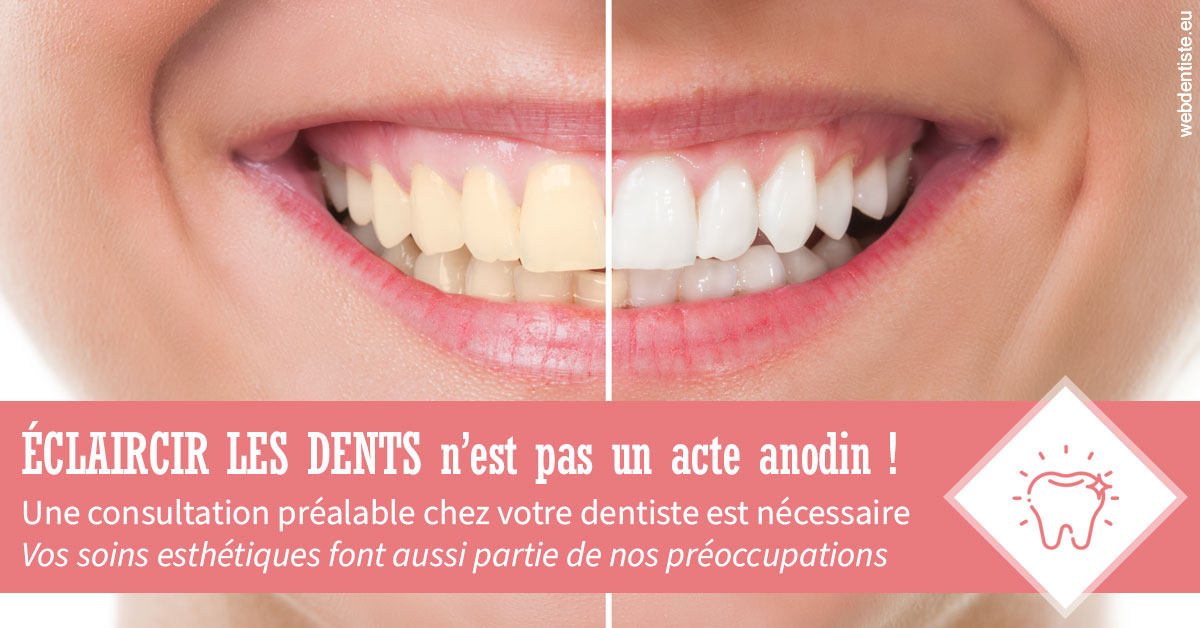 https://dr-laure-roquette.chirurgiens-dentistes.fr/Eclaircir les dents 1