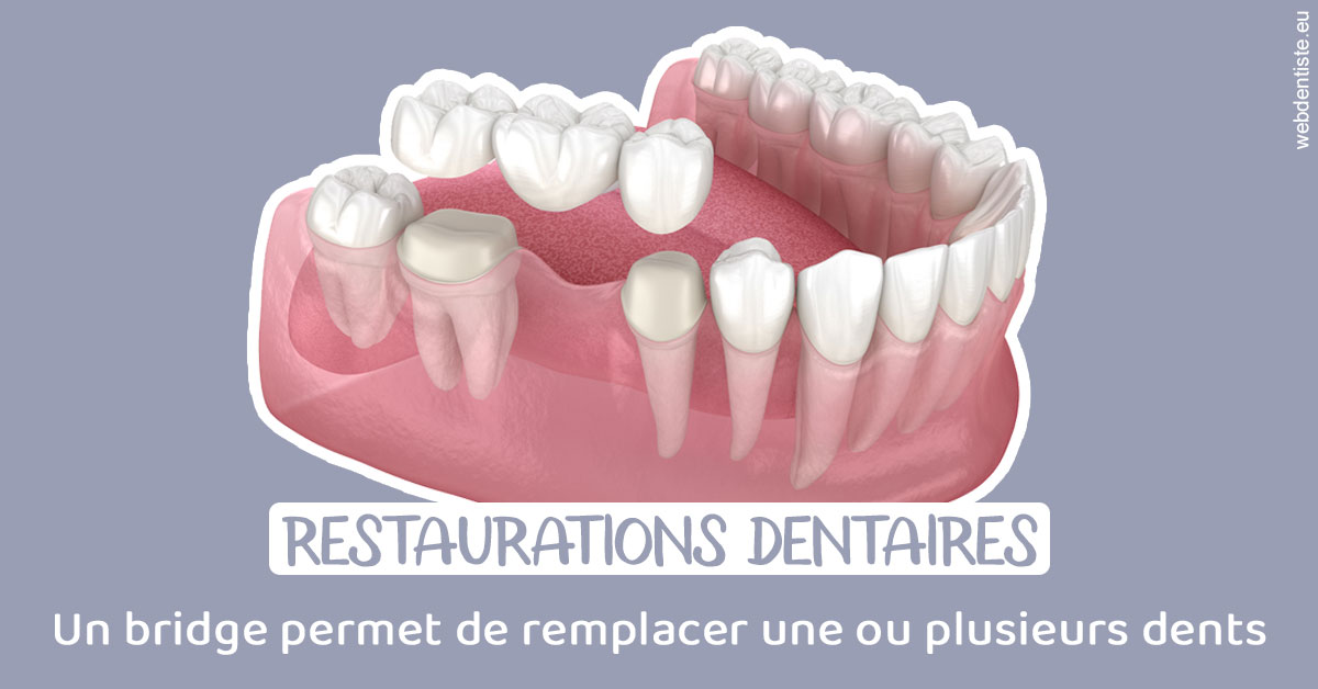 https://dr-laure-roquette.chirurgiens-dentistes.fr/Bridge remplacer dents 1