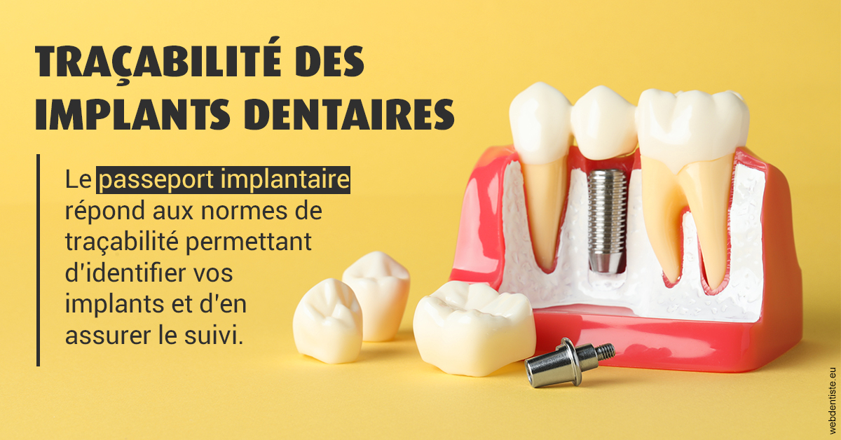 https://dr-laure-roquette.chirurgiens-dentistes.fr/T2 2023 - Traçabilité des implants 2