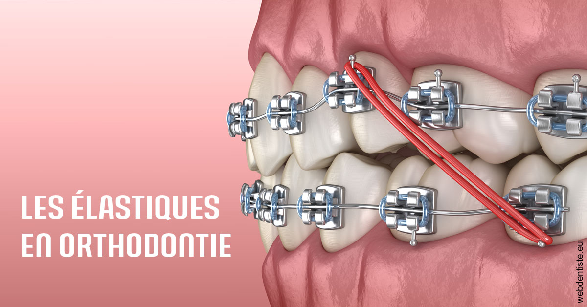 https://dr-laure-roquette.chirurgiens-dentistes.fr/Elastiques orthodontie 2