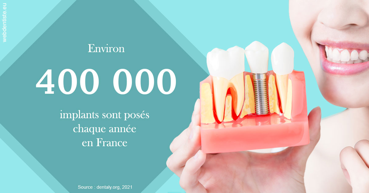 https://dr-laure-roquette.chirurgiens-dentistes.fr/Pose d'implants en France 2